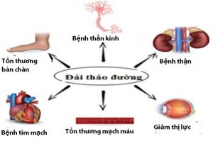 tieu-duong
