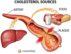 cholesterol-co-phai-nguyen-nhan-gay-nhoi-mau-co-tim-tai-bien-mach-mau-nao-khong