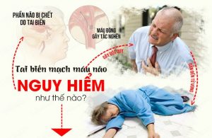 meo-chua-tai-bien-mach-mau-nao
