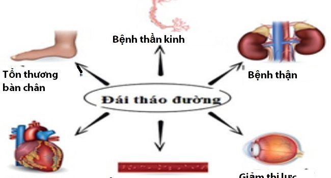 Tiểu đường gây tai biến mạch máu não như thế nào? Tiểu đường gây tai biến mạch máu não như thế nào?