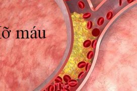 dau-hieu-mo-mau