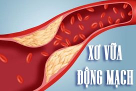 xo-vua-dong-mach