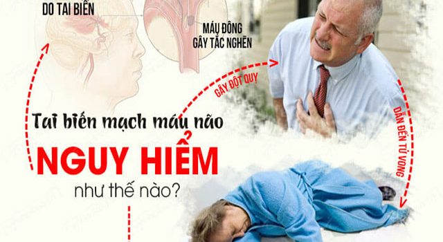 Sự nguy hiểm của bệnh tai biến mạch máu não Sự nguy hiểm của bệnh tai biến mạch máu não