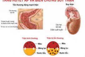 tang-huyet-ap-va-suy-than