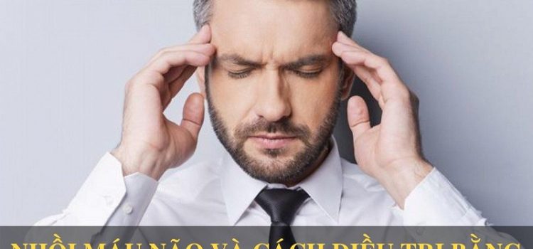 Nhồi máu não và cách điều trị bằng An Cung Trúc Hoàn Nhồi máu não và cách điều trị bằng An Cung Trúc Hoàn