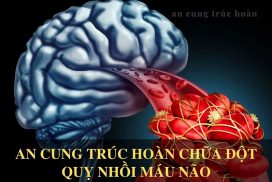 5 đối tượng dễ mắc đột quỵ não nhất